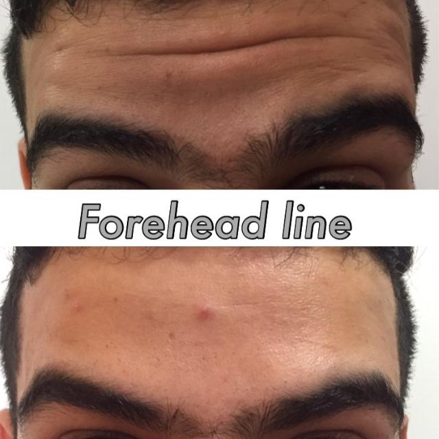 face 11 face 11
