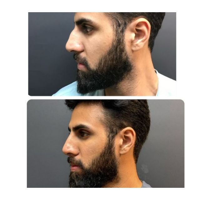 face 14 face 14