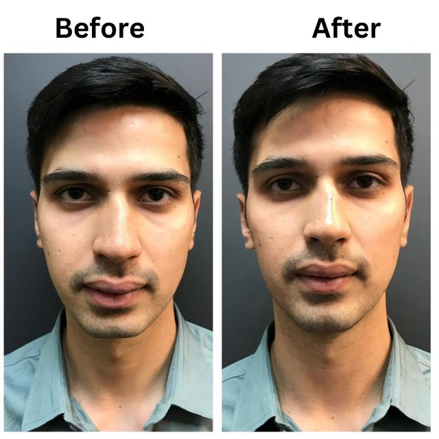 face 3 face 3