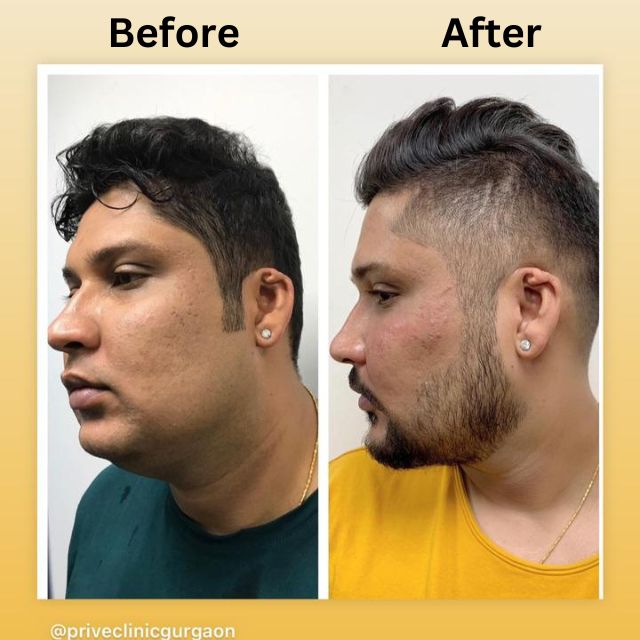 face 7 face 7