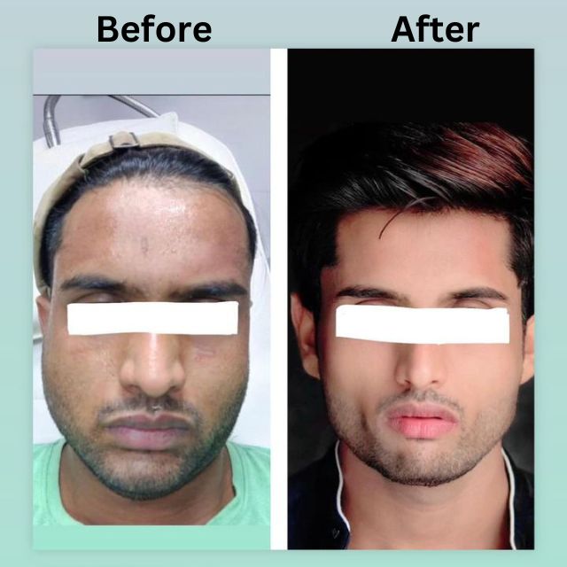 face 8 face 8